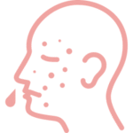 Allergy-150x150 Allergy-150x150